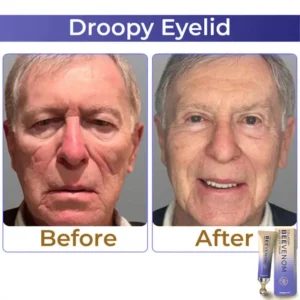 GarageLine™ Collagen+Bee Venom Roller Eye Cream