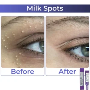 LOVILDS™Retinol Intense Advanced Triple Action Eye Cream